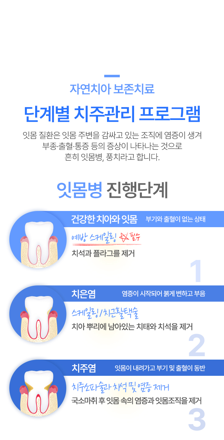 자연치아 보존치료(단계별)