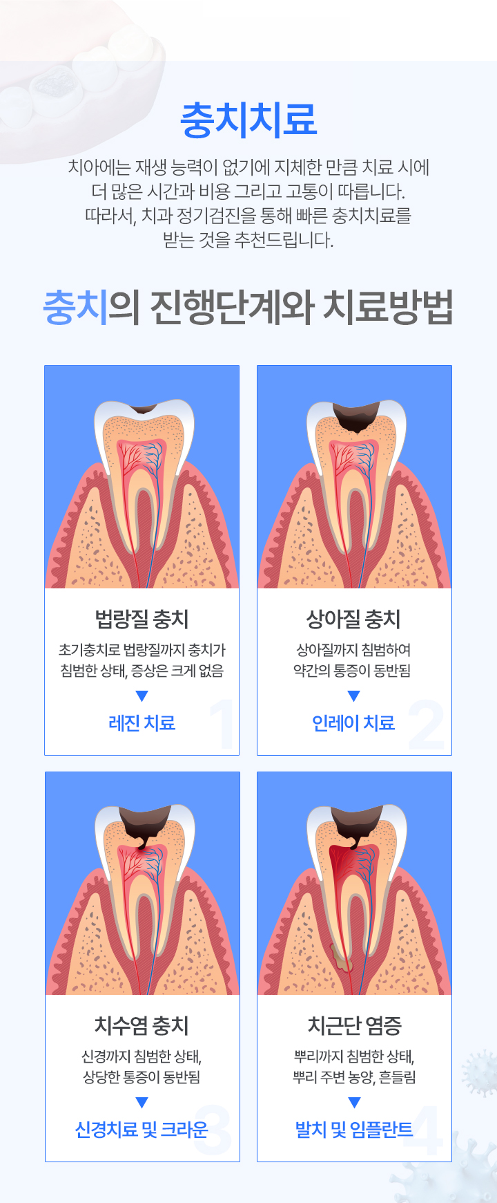 자연치아 보존치료(단계치료)