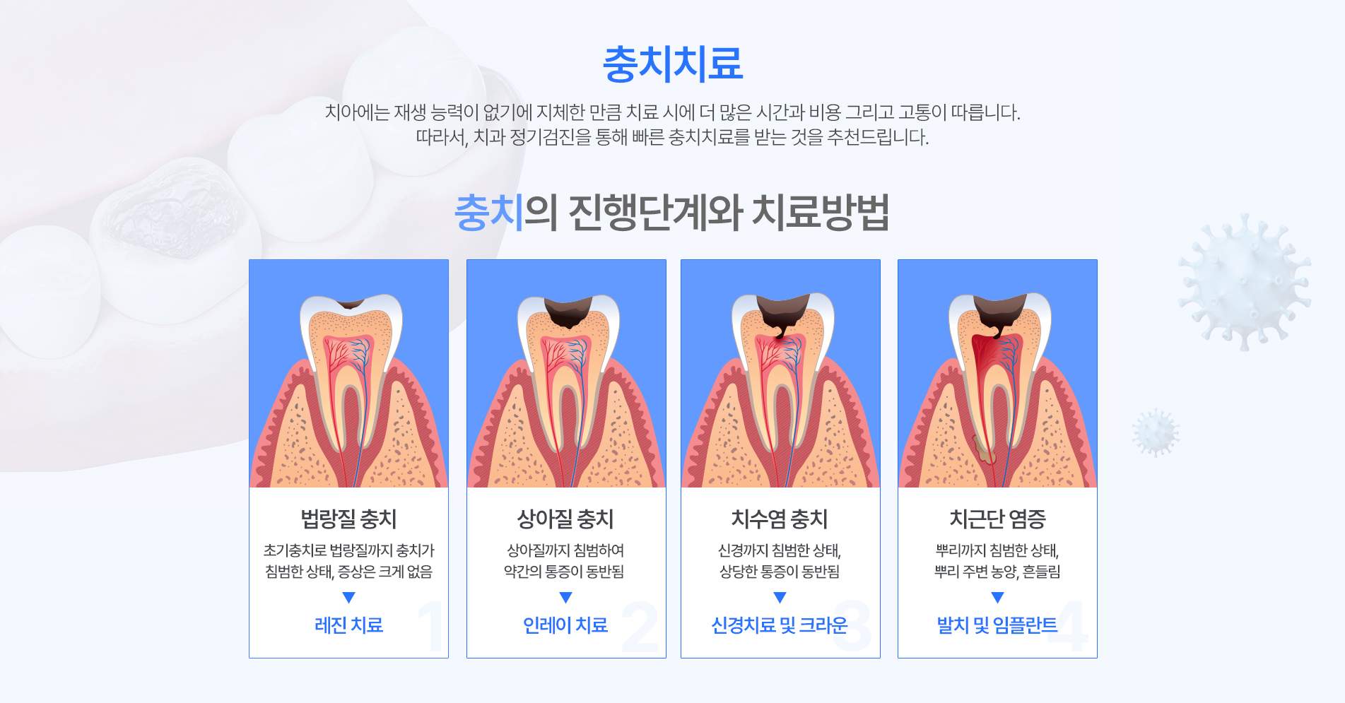 자연치아 보존치료(단계치료)